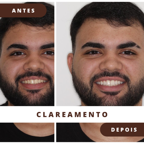 Simple Photocentric Before and After Instagram Post (1)